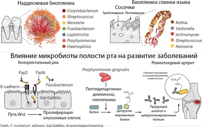 Как избавиться от жжения во рту?. Статьи «ДОКТОР ДЕНТ».