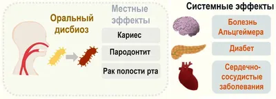 Уход за полостью рта после протезирования зубов - Smile-City