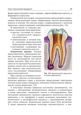 Пародонтит: симптомы, причины, диагностика, профилактика и лечение заболевания  полости рта современными методами