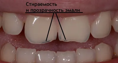 Купить зубные зеркала в Москве | Стоматологические зеркала для осмотра зубов  – СИМКО