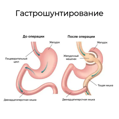 4 правила, которые помогут сохранить здоровый желудок в пожилом возрасте |  InterCOR - о человеке, здоровье, питании и стиле жизни | Дзен