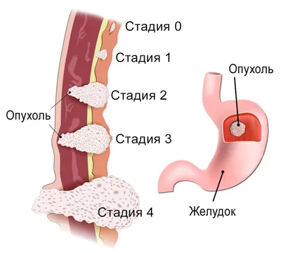 Желудок человека и стенки желудка …» — создано в Шедевруме