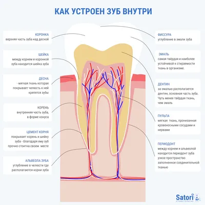 Раскол зуба и одномоментная имплантация