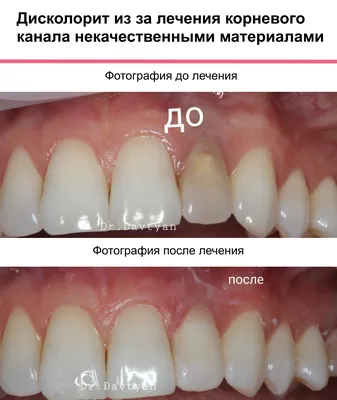 Почему стоматологи говорят 41 зуб, если у человека их всего 32 | Рустем  Галиуллин | Дзен